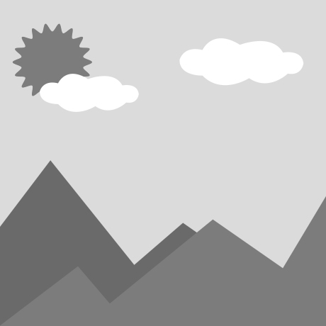 Why Does a Washing Machine Motor Produce Excessive Noise and Vibration?